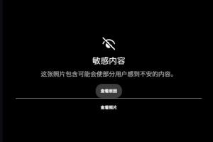 惊悚！慎入！范德彪小拇指骨头裸露在外！